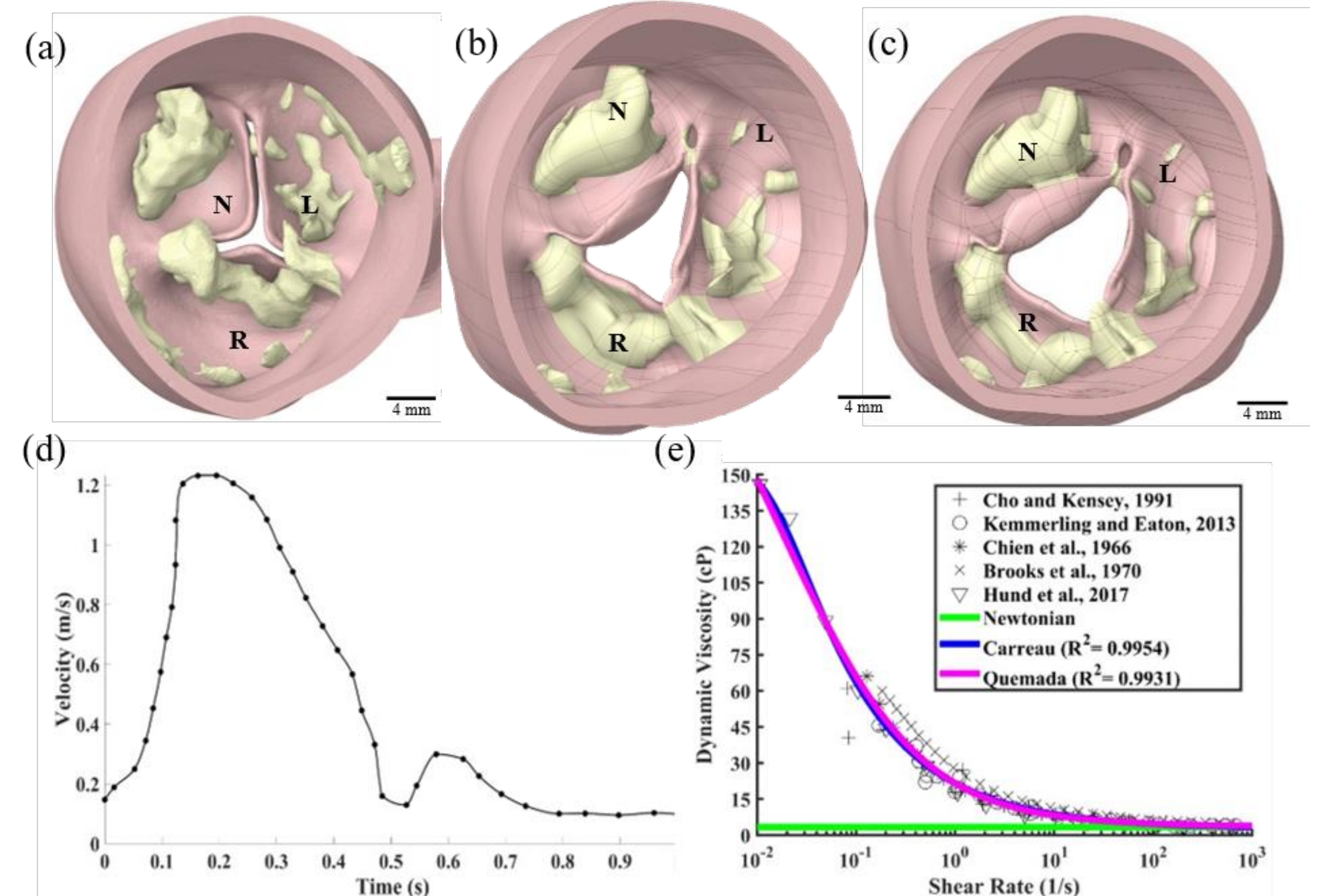 Figure 4-1: CFD model preparation