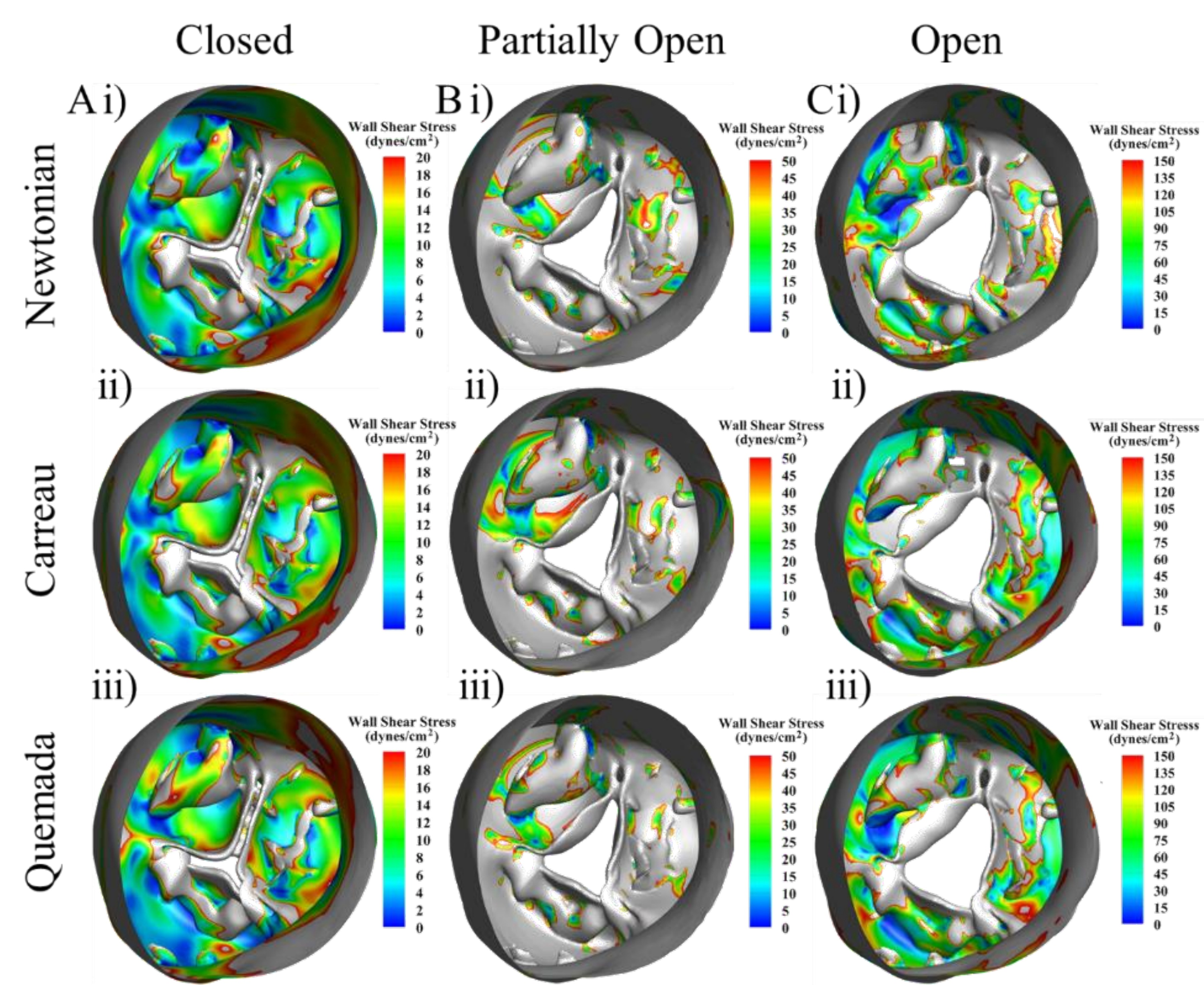 Figure 4-3: WSS Newtonian vs non-Newtonian