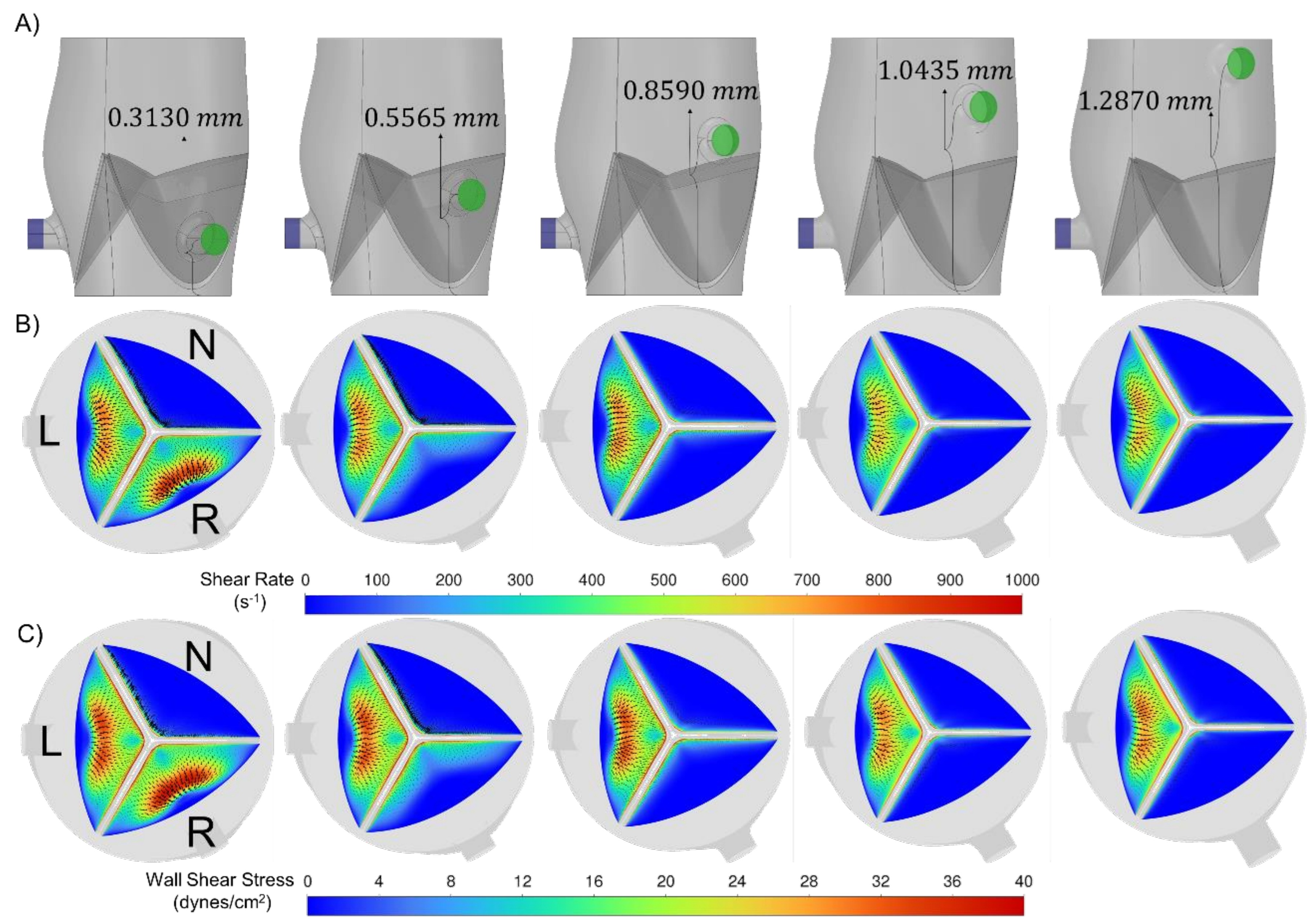 Figure 6-2: Right coronary ostium WSS maps