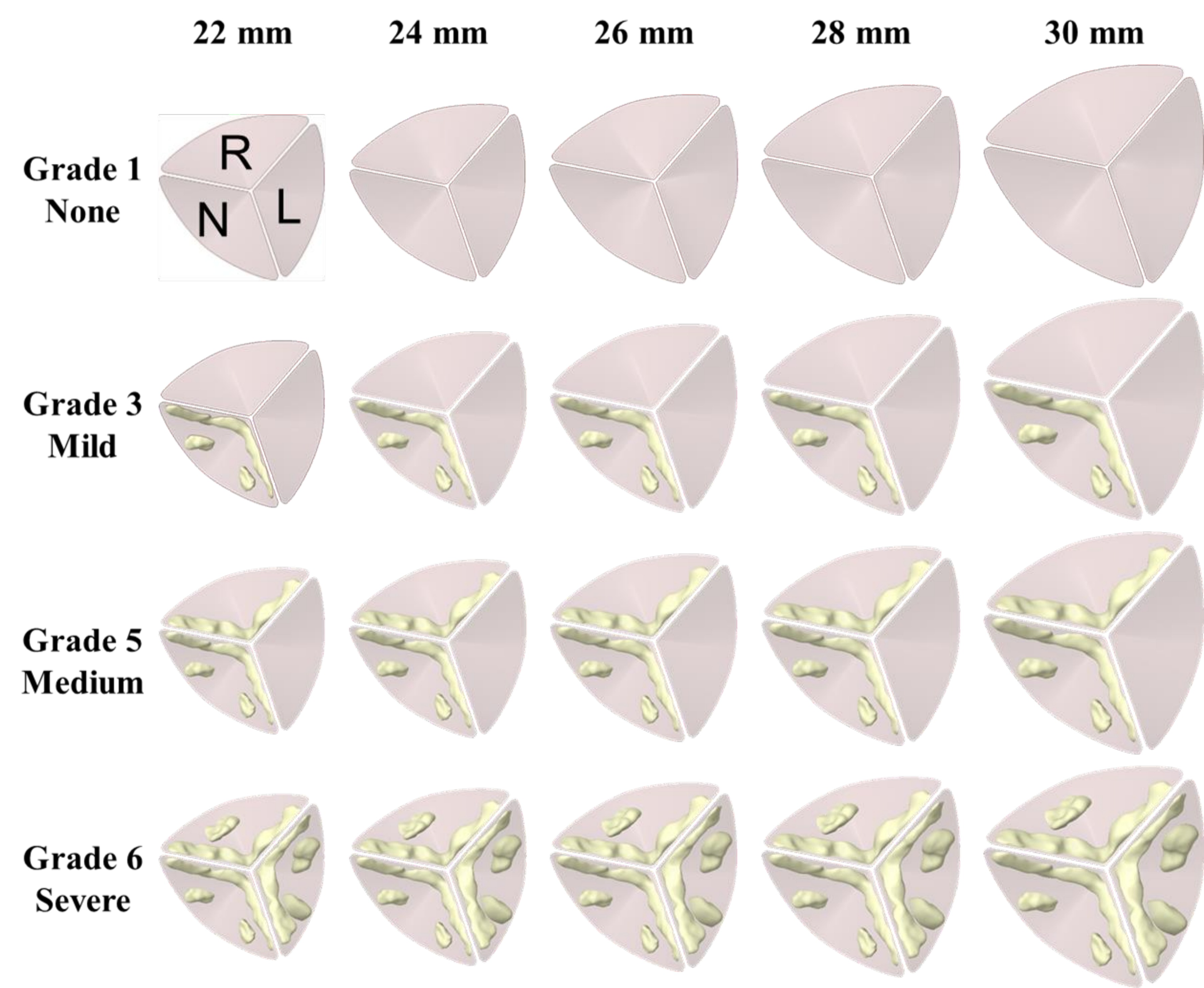 Figure 7-1: CAVD grades × valve sizes
