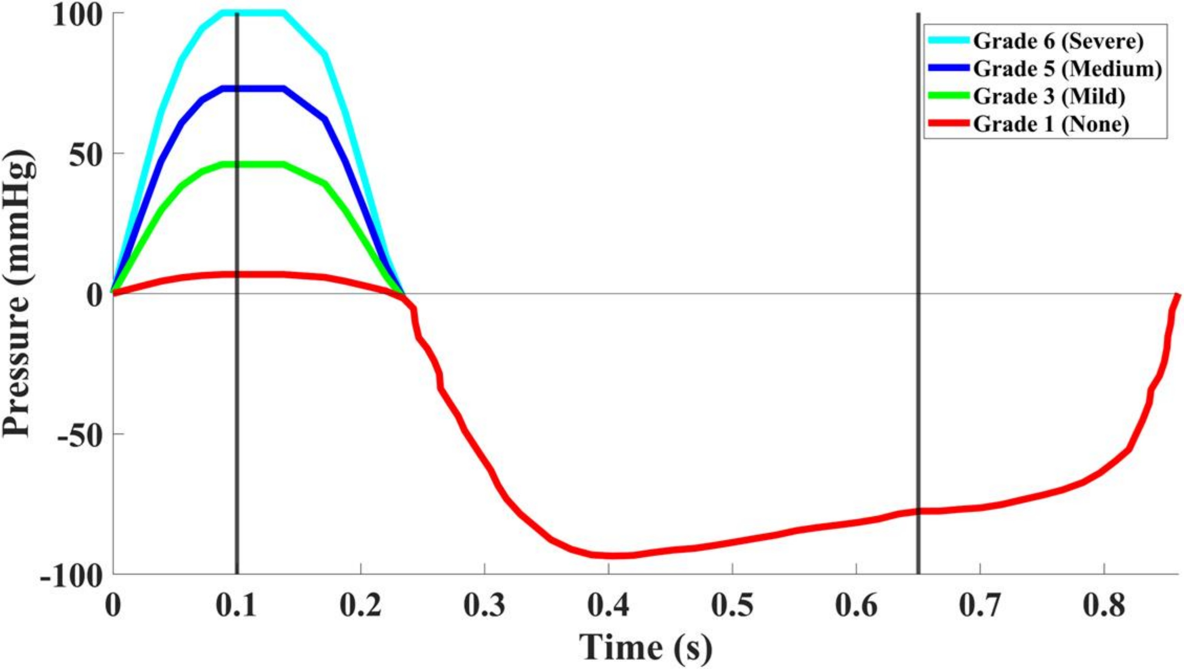 Figure 7-2: Inlet pressure BCs per grade