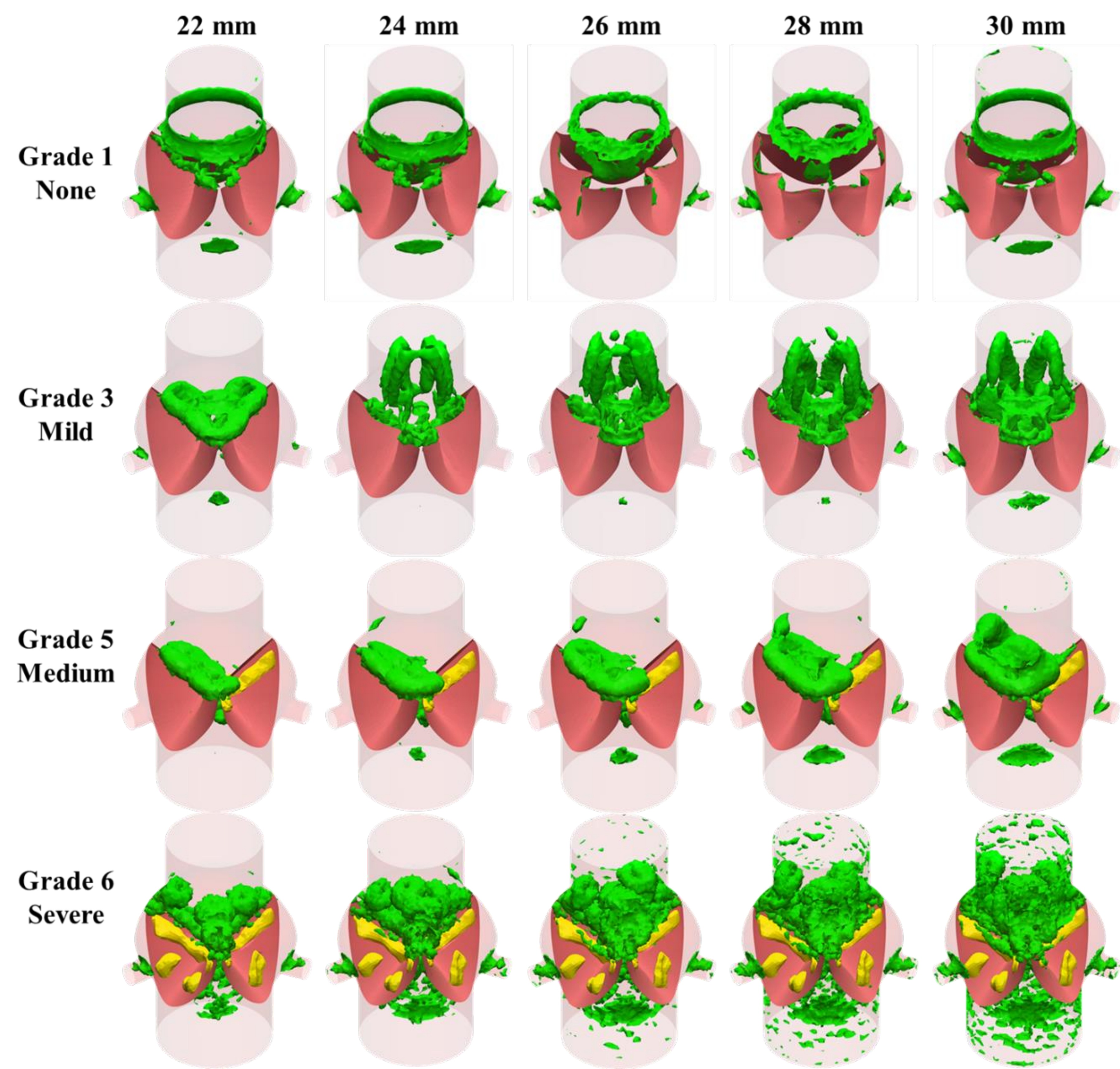 Figure 7-4: Q-criterion vortex formations